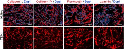 Development and characterization of a novel injectable thyroid extracellular matrix hydrogel for enhanced thyroid tissue engineering applications